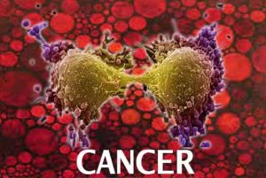 cancer
